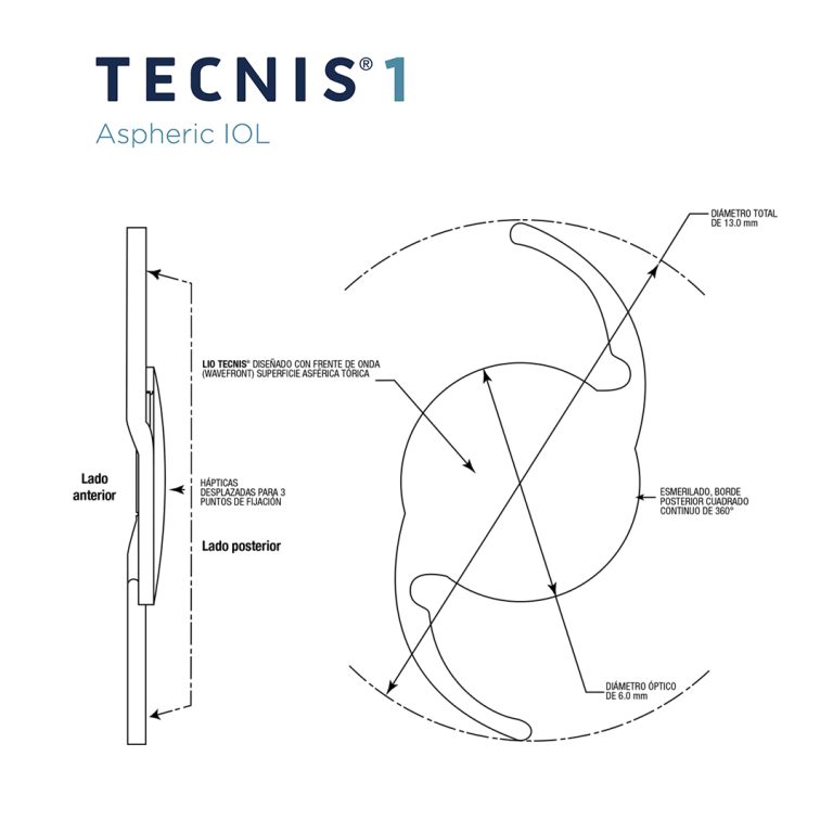 LIO TECNIS® 1 DCB00- MONOFOCAL - 1 pieza -Johnson & Johnson Vision ...